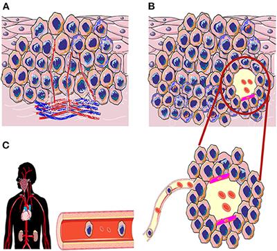 Vasculogenic Mimicry in Head and Neck Squamous Cell Carcinoma—Time to Take Notice